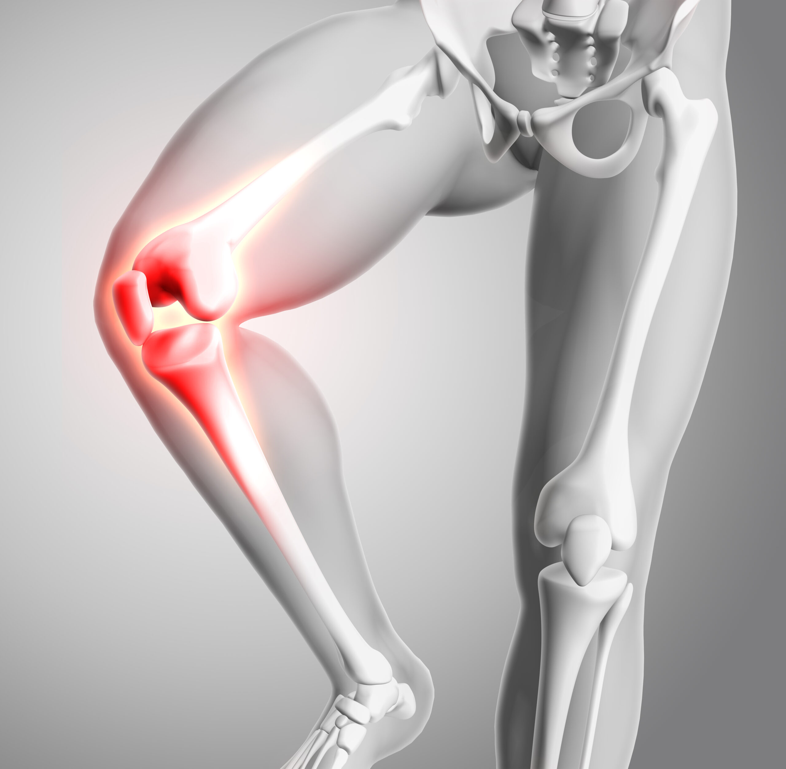 best doctor for knee pain in gurgaon